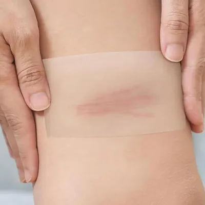 Pansement hydrocolloïde en rouleau imperméable – image 3